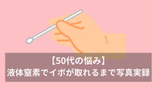 アイキャッチ　液体窒素でイボ治療