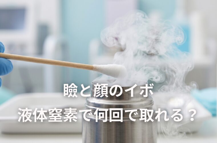 瞼と顔のイボは液体窒素で何回で取れる？3回通った私の経過報告